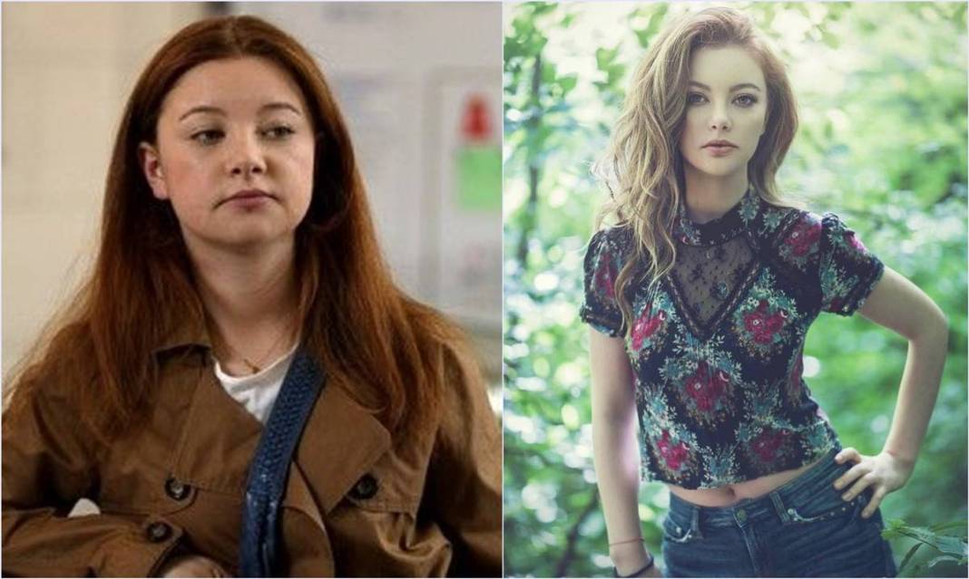 'Açık yüreklilikle söylüyorum, aldırdım' demişti, son halini görenler tanımakta zorlandı! Eski halinden eser kalmadı 5